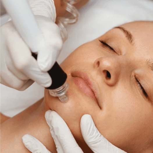80 Minute Hydro Lift Pkg of 3 at Wellington Skin Studio in Wellington, FL